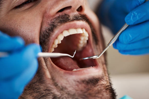 Best Weekend Emergency Dentist in Oak Ridge North, TX