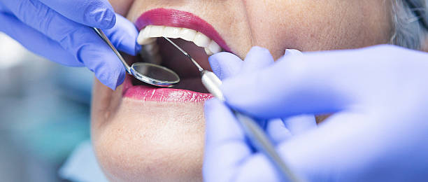 Best Urgent Care for Lost Fillings or Crowns in Oak Ridge North, TX